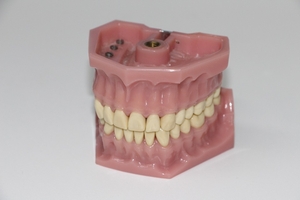 Изберете избелване на зъби 30