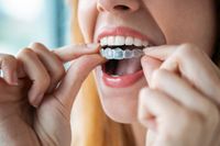 изправяне на зъби - 32578 клиенти